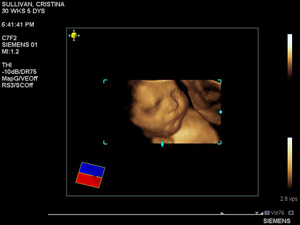 a peek in the pod ultrasound